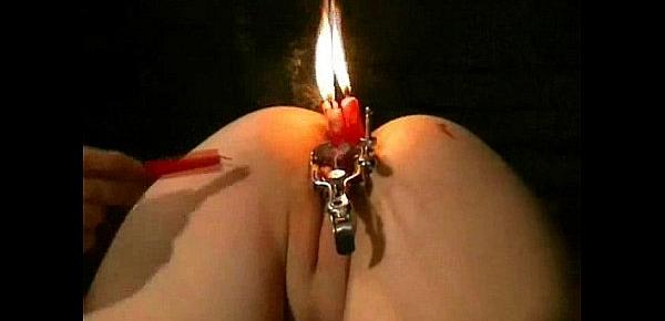  Cherry Torns Burning Pussy Pain and Bizarre Speculum